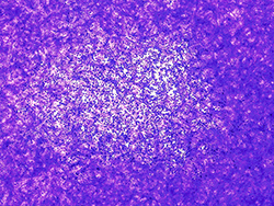 An image of Zika virus disrupting healthy cells.